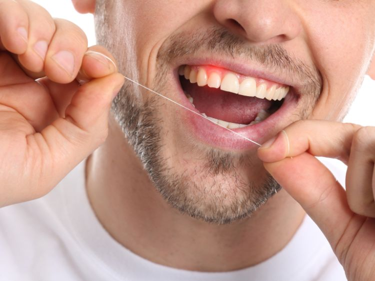 blødning fra tannkjøttet, alvorlig periodontitt