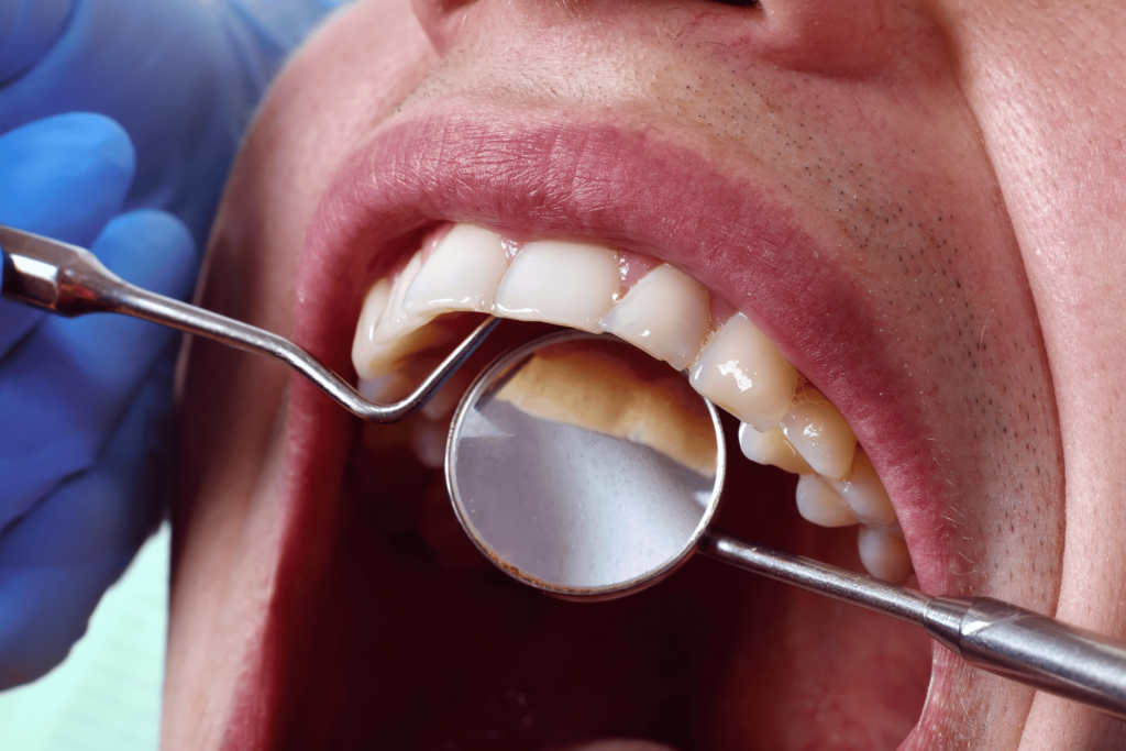 Tannsjekk og tannundersøkelse