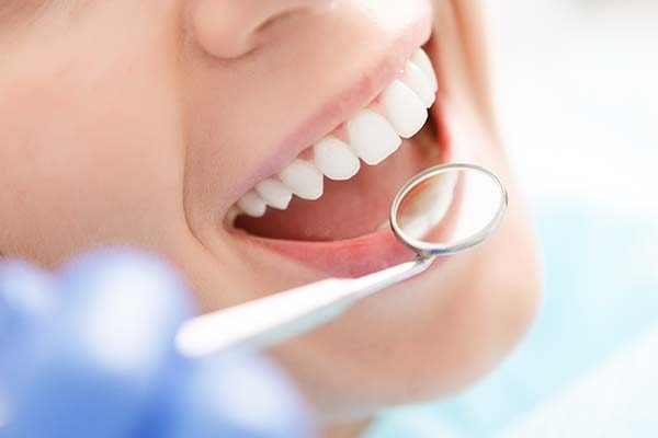 Usynlig tannregulering kan hjelpe deg å få rette tenner
