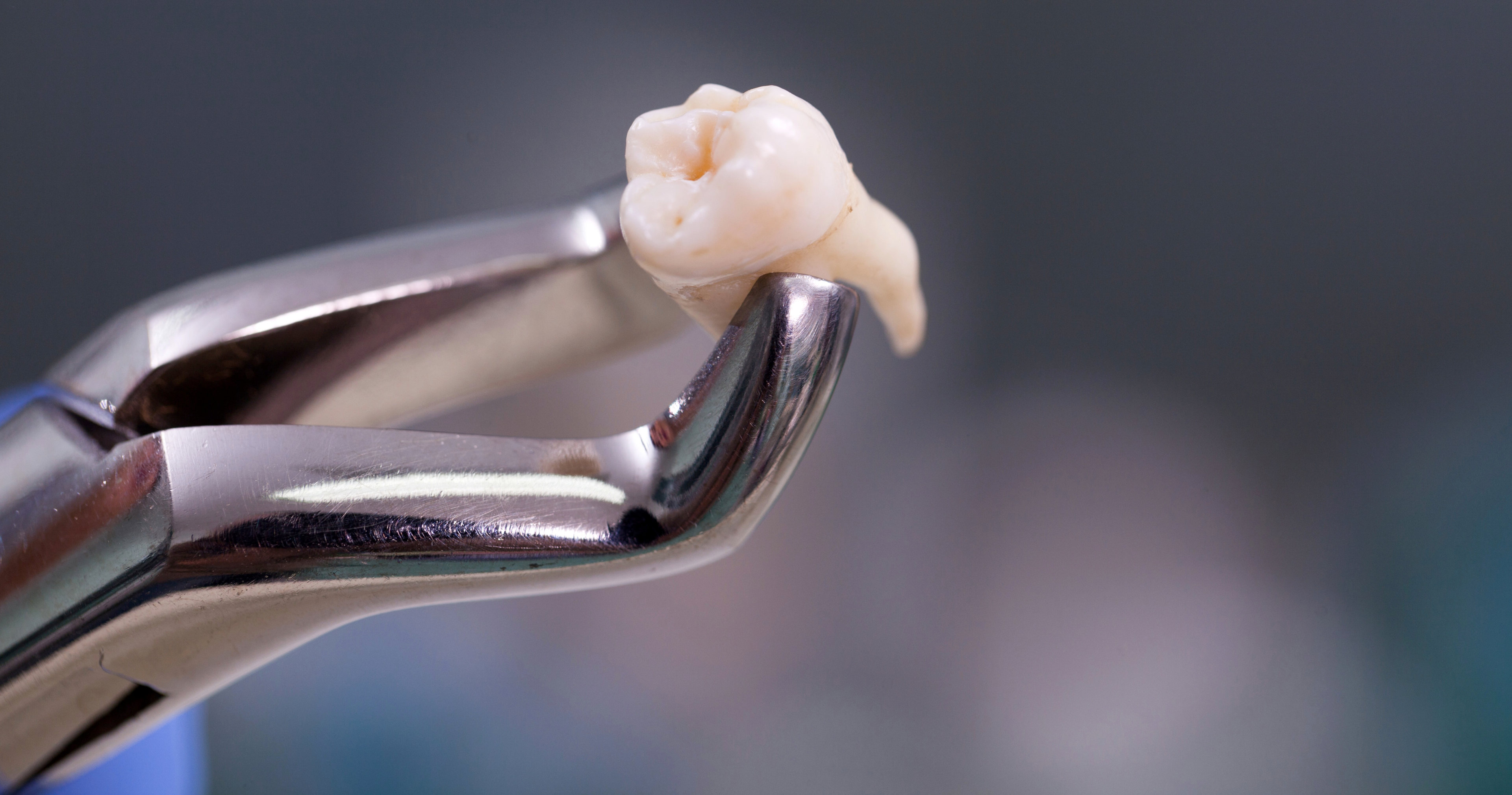 En tannlege som har trukket en tann