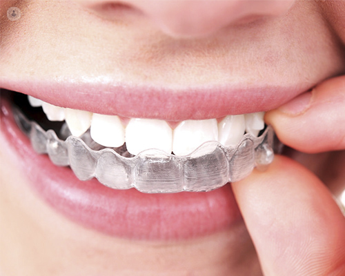 Den vanligste usynlige tannreguleringen er invisalign