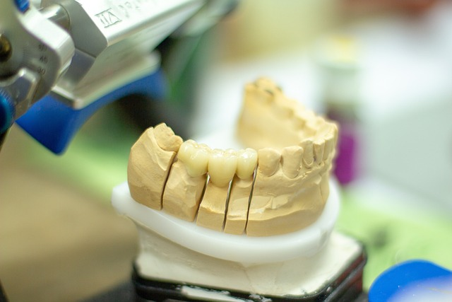 Tanntekknikker lager en protese - estetisk tannbehandling