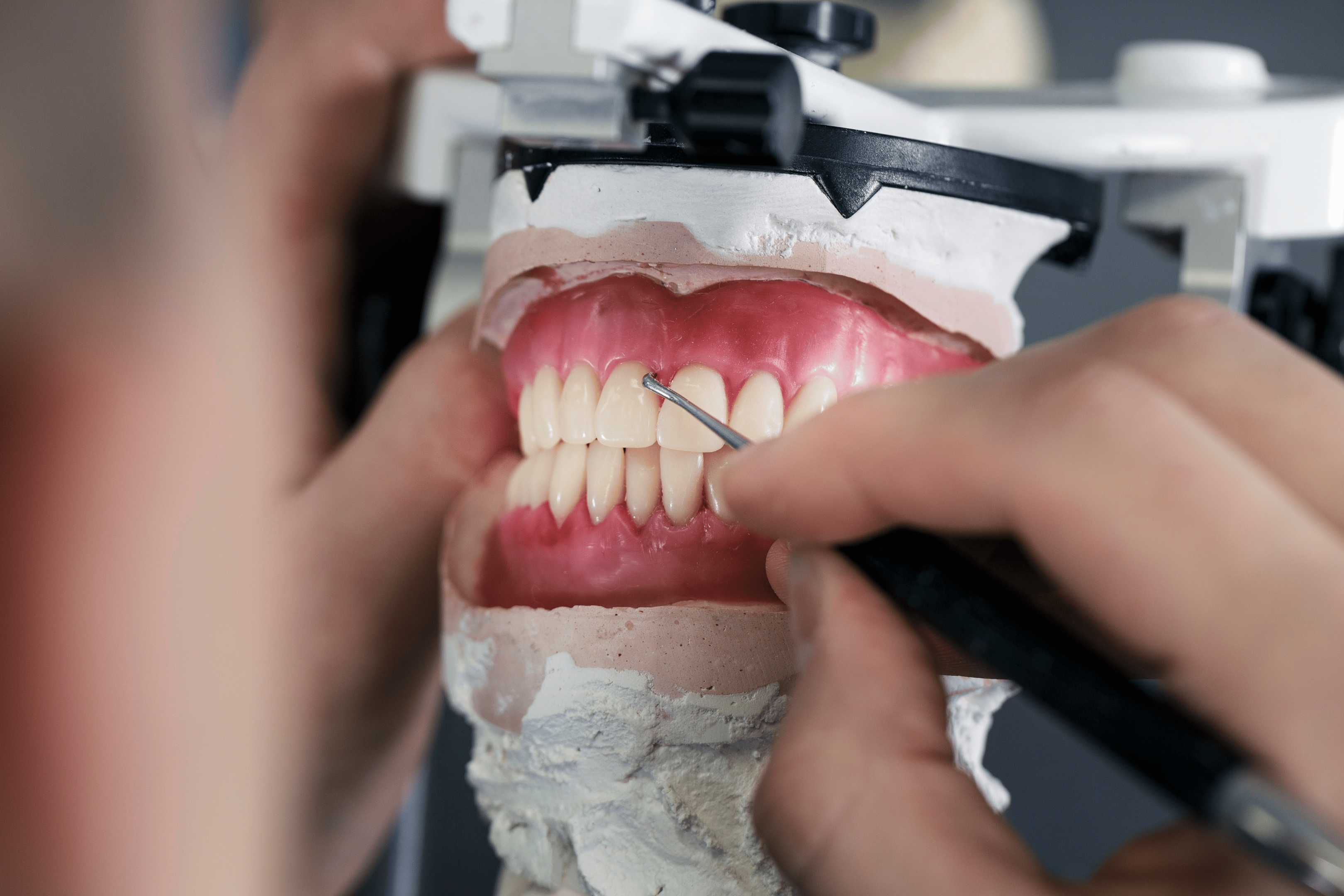 Tannprotese blir laget av teknikker